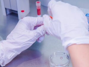 Hemofilia y elección terapéutica del sexo de tu bebé