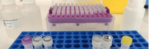La Unidad de Reproducción Vistahermosa ofrece el nuevo test genético embrionario no invasivo