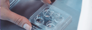 Selección espermática por microfluidos